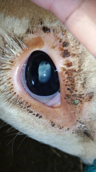 Congenital Cataracts